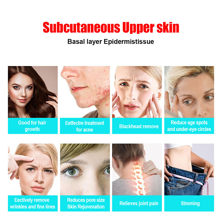 red light face therapy